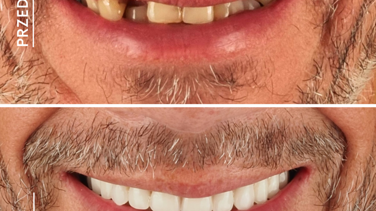 Dental Studio - zęby w 1 dzzień