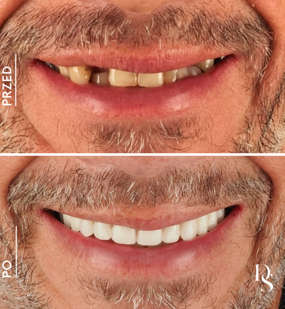 Dental Studio - zęby w 1 dzzień